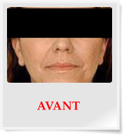 AVANT