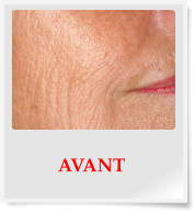 AVANT