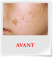 AVANT