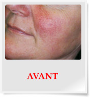 AVANT