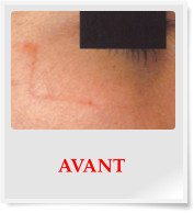 AVANT