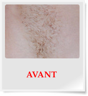 AVANT