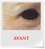 AVANT
