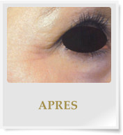 APRES